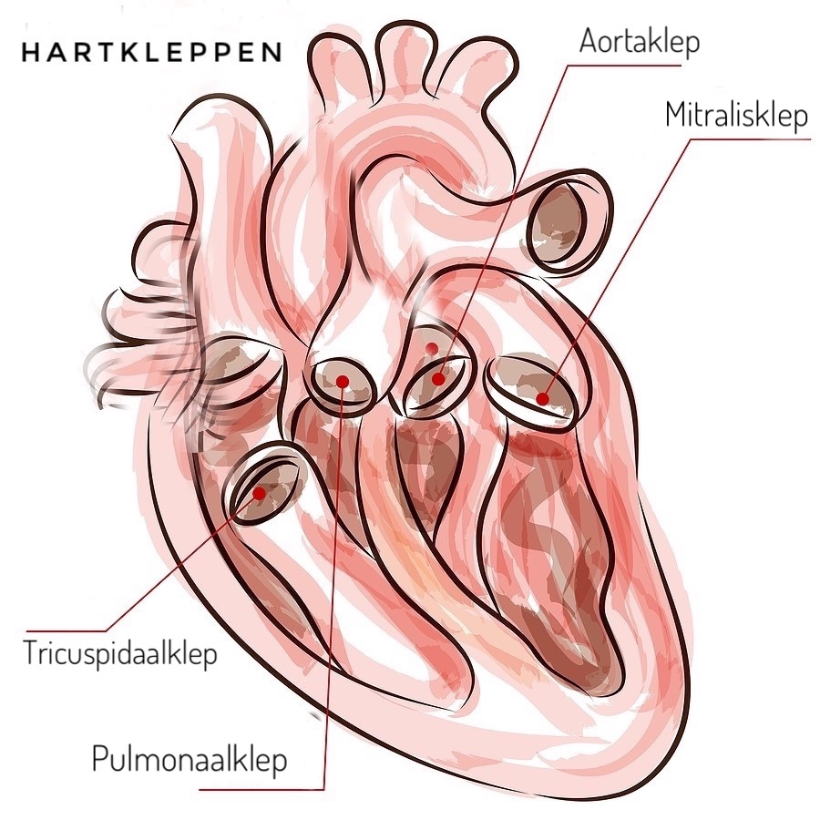 Hartklepontsteking (endocarditis) Tergooi MC Hartklepontsteking (endocarditis) Tergooi MC