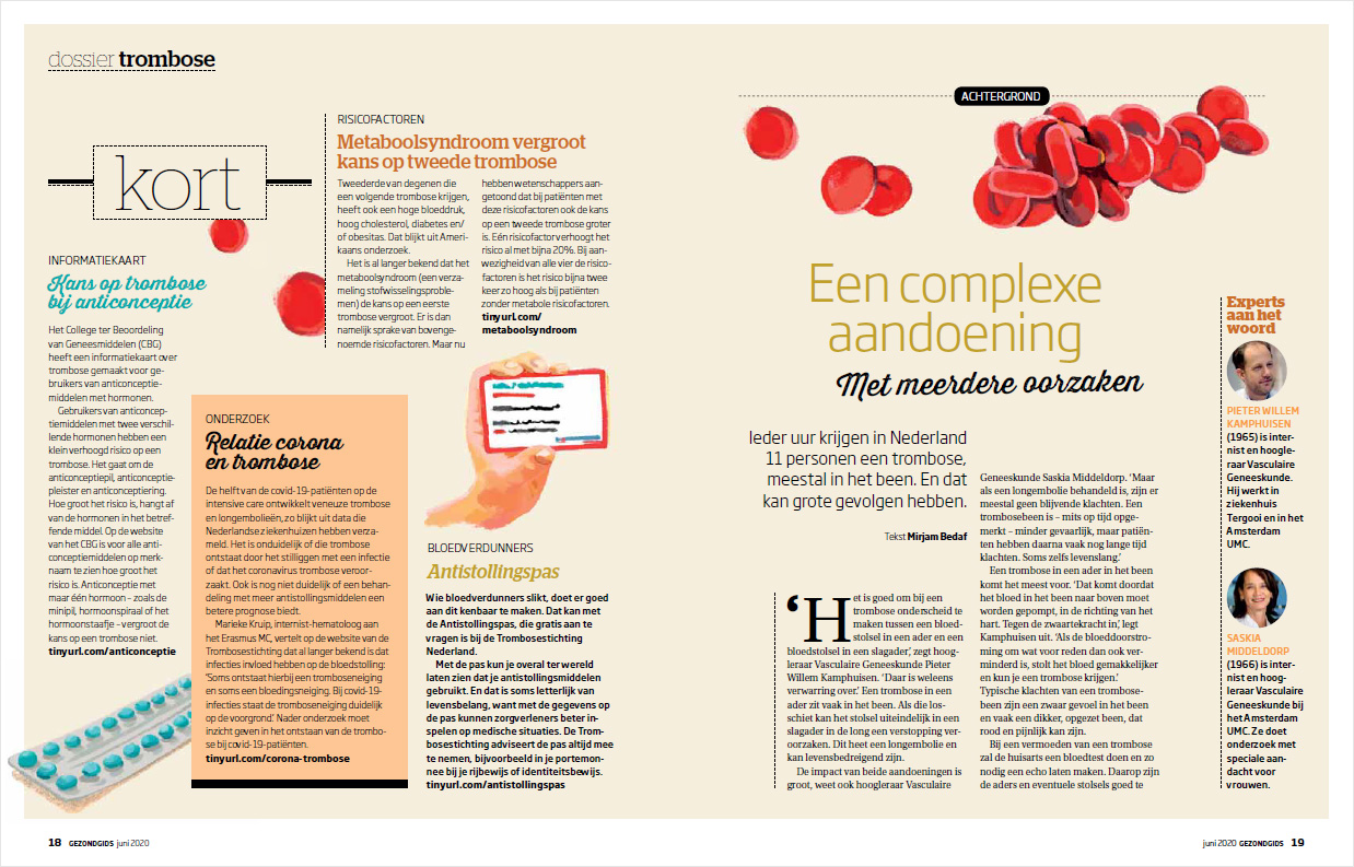 Lees het dossier over trombose in de Gezondgids van de Consumentenbond